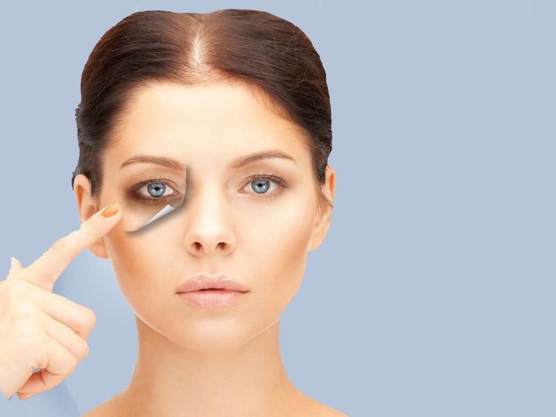 Effective Ways to Remove Dark Eye Circles