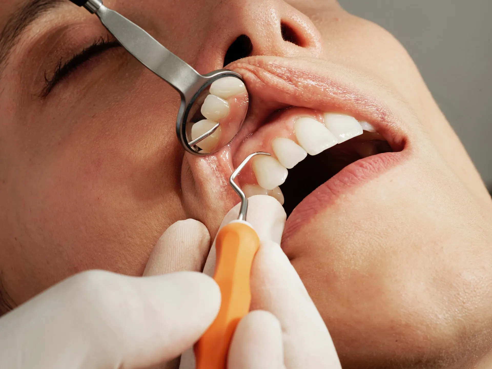 Is There Any Perfect Order To Receive Cosmetic Dental Treatments?
